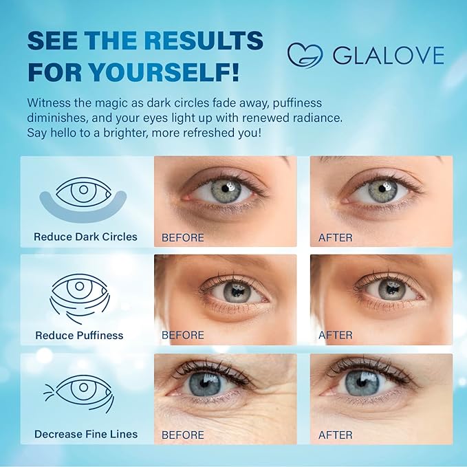 Under Eye Patches for Puffy Eyes: 60 Count Retinol Collagen Eye Gels Pads - Eye Skin Treatment Mask for Dark Circles, Wrinkles Puffy & Bags - Anti-Aging & Rejuvenating Eye Masks Women, Men (Blue)