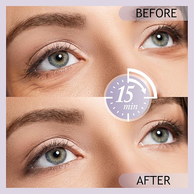 Shvyog under eye patches (20