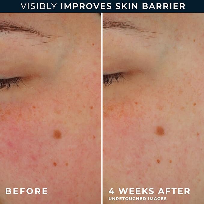 RoC Barrier Renew Day Cream with SPF 30, Moisturizer with Ceramides & Prebiotics to Protect Skin Barrier, (2.5 oz) with Retinol Eye Cream Packette