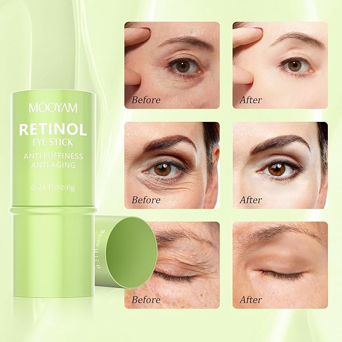 Retinol Eye Cream Brightening Eye Stick Anti-aging Eye Cream for Dark Circles and Puffiness Dark Circles Under Eye Treatment Under Eye Cream Puffy Eyes Treatment Firm Eye Bags Treatment for Men Women