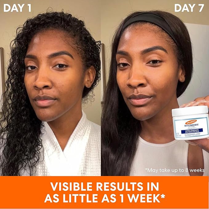 Palmer's Skin Success Extra Strength Tone Correcting Face Cream, 2.7 Fl Oz, Dark Spot Corrector for Discoloration, Age Spots and Post-Acne Marks