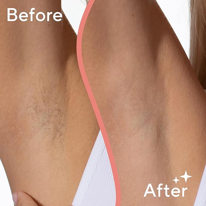 Finishing Touch Flawless Underarm Hair Removal Electric Razor Device, Designed to Shave and Contour Womens Sensitive Underarm Area, Cordless Groomer, Painless for All Skin Types