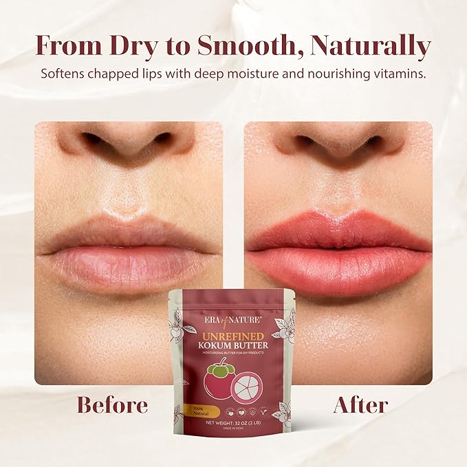 era of nature Kokum Butter Raw - 32 oz (2lb) – Natural Butter for Body Butters, Lotion Bars, Lip Balm, Soap Making – Blends Well with Shea or Cocoa Butter – For Stretch Marks, Scars, Pregnancy Care