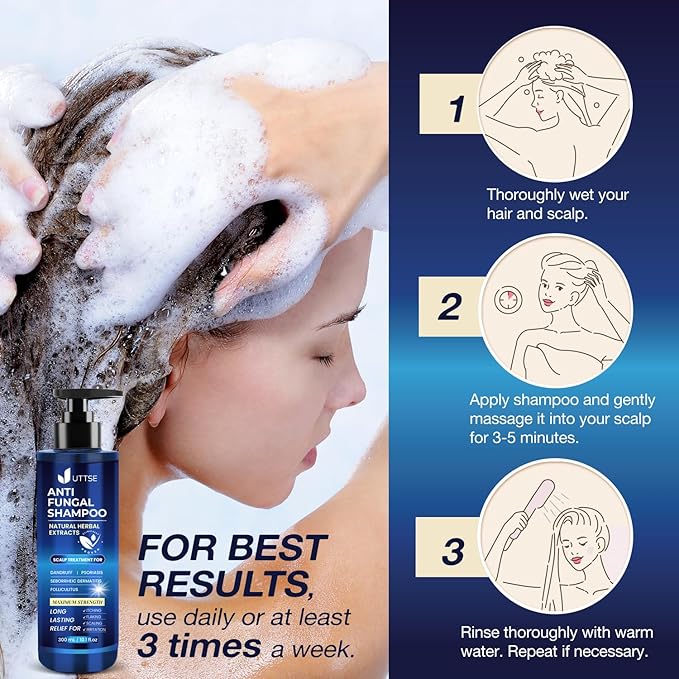 Anti-Fungal Shampoo for Scalp Psoriasis: Dandruff Shampoo for Folliculitis and Seborrheic Dermatitis - Relieves Itchy & Dry Scalp - 300 mL / 10.1 fl.oz