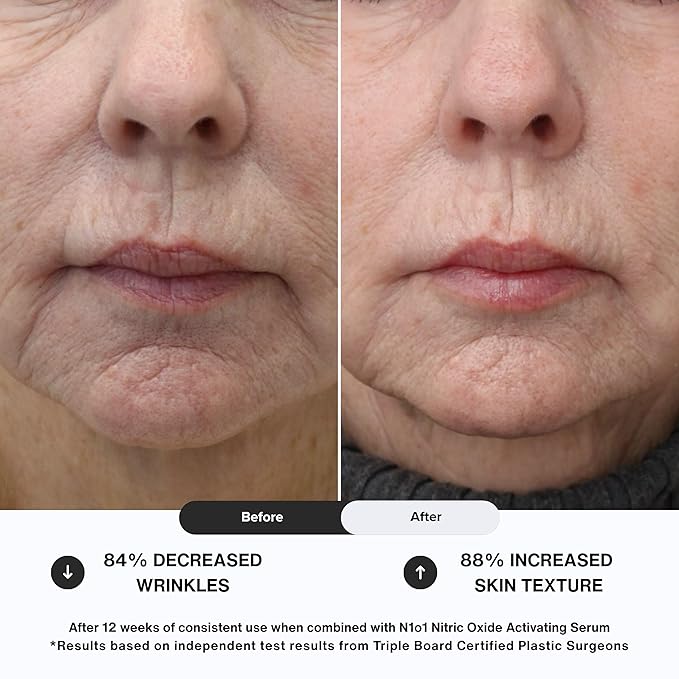 Moisturizer Face Cream - Day & Night Face Moisturizer with Nitric Oxide, Peptide Complex, Epidermal Growth Factor - Tightening & Firming Skin Care Products for Wrinkles, Dark Spots - 1.75 oz.