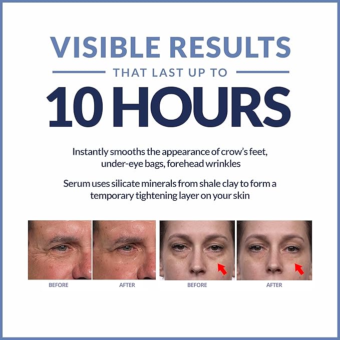 Plexaderm rapid reduction eye serum