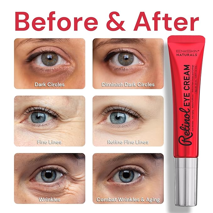 Retinol eye cream for anti-aging: