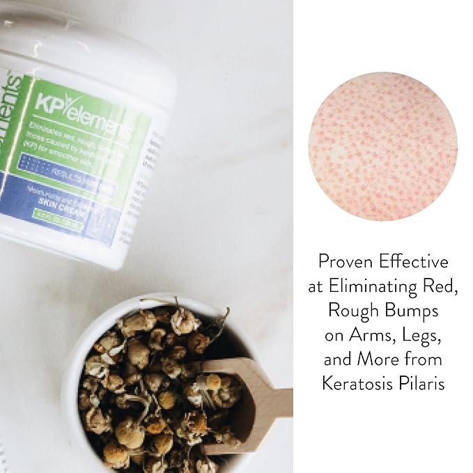 KP Elements Keratosis Pilaris Lotion (4 fl oz) - Natural Keratosis Pilaris Treatment, Moisturizing & Exfoliating AHA Lotion for KP, Vegan, Made in USA