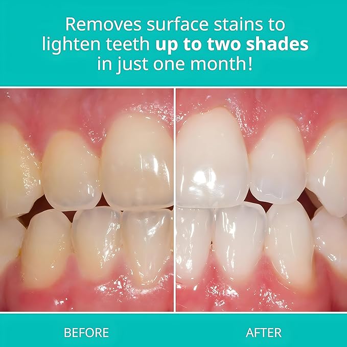 Opalescence Whitening Toothpaste for Sensitive Teeth (12 Pack) - Oral Care, Mint Flavor, Gluten Free - 5167-12