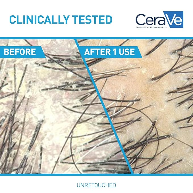 CeraVe 2 In 1 Hydrating Anti Dandruff Shampoo And Conditioner, 1% Pyrithione Zinc Dandruff Treatment, Color Safe & Sulfate Free Shampoo And Conditioner, Helps Eliminate Dandruff & Relieve Itchy Scalp