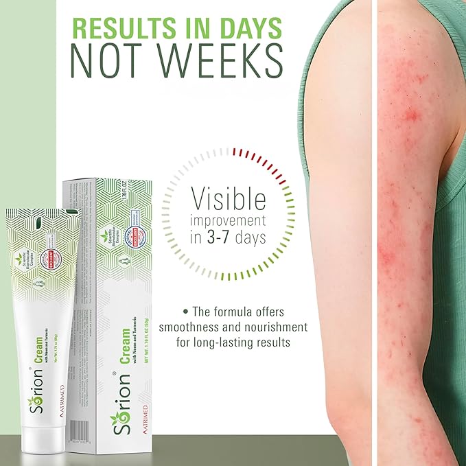 Sorion Cream - Herbal Moisturizer for Dry, Itchy, Flaky Skin with Coconut Oil, Neem, Turmeric and Pala Indigo Plant Skincare