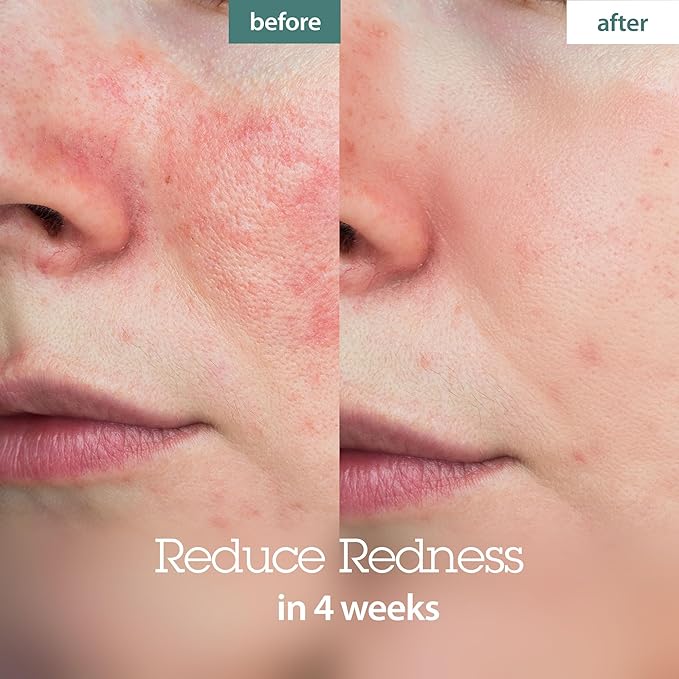 BLITHE Pressed Serum Crystal Iceplant Face Moisturizing Gel - Kbeauty Best Skin Cream for Dry Skin, Korean Serum for Combination Skin & Redness Relief, Face Moisturizer for Dry Skin Cream 0.91 Oz