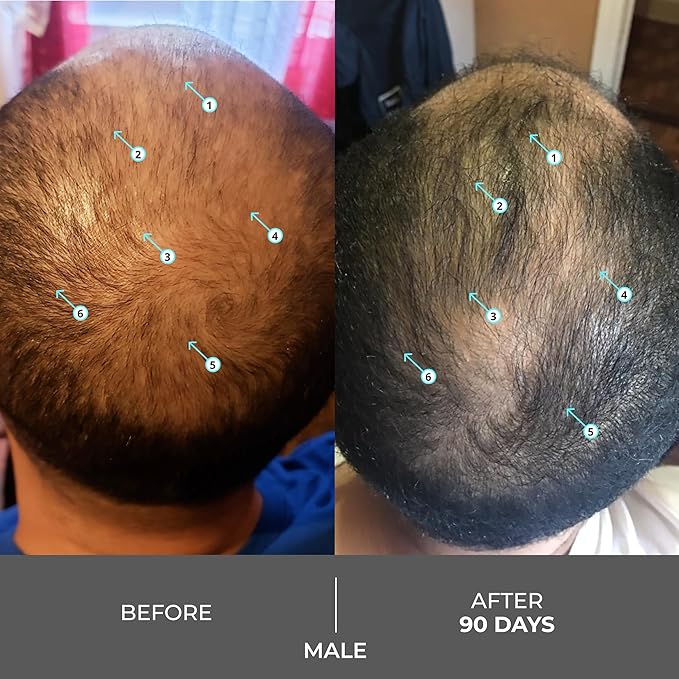 DS Labs Revita Extra Strength Shampoo - High-Performance Hair Density Shampoo, Volumizing & Thickening, Fuller Looking Hair, Saw Palmetto, Sulfate & Silicone Free, For Men & Women, 205mL