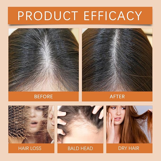 Hair Ampoule Treatment, Hair Growth Ampoules with Turmeric Root Extract, Hair Lotion for Damage and Dry, Instant Hair Strength Ampoule for Women & Men, 7pcs