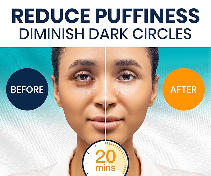 Stylia Collagen & Vitamin C Under Eye Patches for Puffy Eyes & Dark Circles - Depuffing, Hydrating & Firming Under Eye Mask with Hyaluronic Acid - Vegan, Cruelty-Free Skincare (30 Pairs)