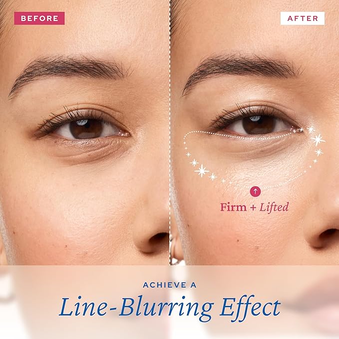 belif Aqua Bomb Lifting Eye Gel | Retinol + Collagen + Peptide for Firming & Plumping | Hyaluronic Acid for Glowy Hydration | Niacinamide for Dark Circles | Korean Skin Care