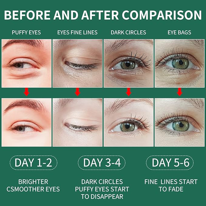 Green Seaweed Under Eye Masks (60 pcs),Eye Hydrolyzed Collagen Patches, Eye Gel Treatment Masks,Eye Pads for Dark Circles,Puffy Eyes,Under Eye Bags,Moisturizing,Anti-aging