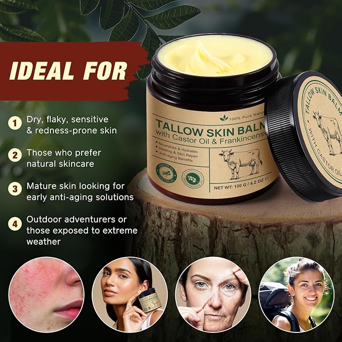 Tallow Castor Oil Frankincense Oil Handmade Skin Balm, Face & Body Moisturizer for Sensitive Skin, Eczema All-Purpose Balm, 100% Grass-Fed Tallow for Skin Care
