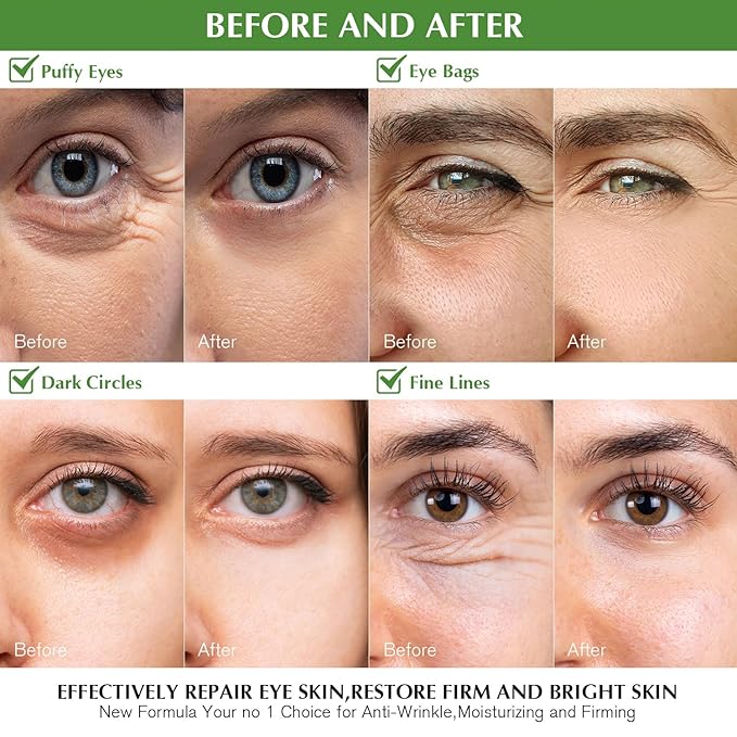 Under Eye Patches for Dark Circles: 30 Pairs Green Tea Eye Gels Pads - Reduce Eye Bags, Wrinkles & Puffy - Skin Treatment Mask Retinol Collagen - Anti Aging & Face Moisturizer For Women (Green Tea)