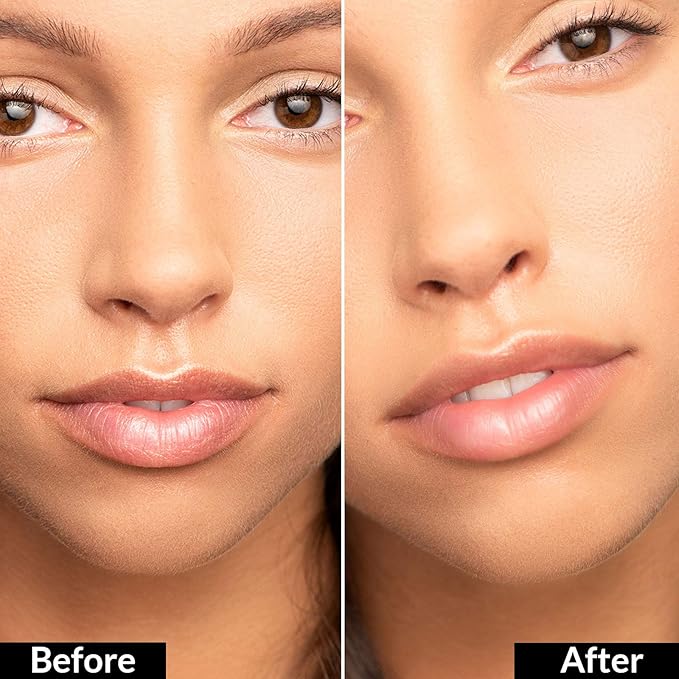 True + Luscious Flowerdose Lip & Eye Serum – 2-in-1 Lip Plumping & Eye Serum for Dry Lips and Dark Circles – Intensely Hydrating, Anti-Aging Formula – 0.5 oz