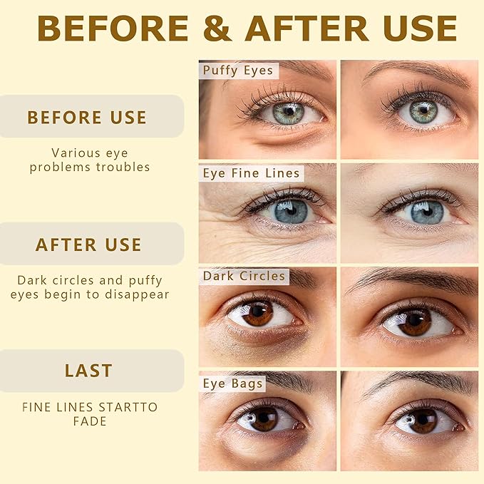 COSMETIC |24k Gold Vitality-Fill Hydra-Gel Eye Patches | Anti-Aging Under-Eye Patches, Help Boosting Lift & Firm the Look of the Eye Area