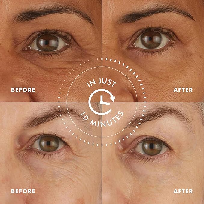 skyn ICELAND Hydro Cool Firming Under Eye Patches, Instant Cooling for Puffy, Tired Eyes with Peptides and Coenzyme Q10, 10 Minute Treatment, Vegan, All Skin Types, 8 Pairs