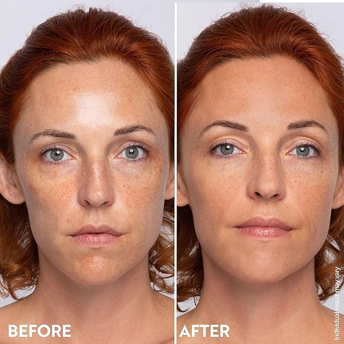 M. Asam Magic Finish Summer Teint Make-Up Mousse (1.01 Fl Oz) – 4in1 Primer, Foundation, Concealer & Powder With Buildable Coverage, Hides Redness And Dark Spots, Vegan, For Medium To Deep Skin Tones