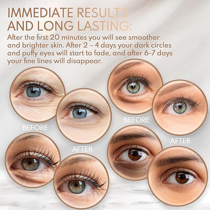 Under Eye Anti-Aging Eye Mask Collagen Patch Treatment for Minimizing Wrinkles, Puffy Eyes, Eye Bags, Dark Circles, Fine Lines Under the Eye, Looking Less Tired, Revitalizing, Moisturizing and Refreshing Your Skin 12 Pairs (Gold)