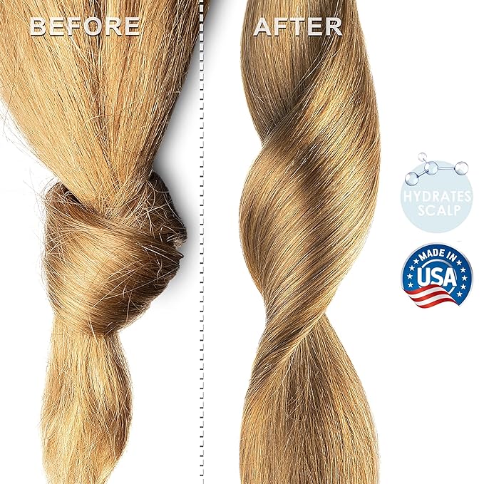 Soapeauty MEADOWFOAM SEED OIL Cold Pressed Unrefined | 100% Pure Natural Meadowfoam Seed Oil for Face & Hair | Moisturizer for Skin, Promotes Hair Growth, Balms | (32 OZ)