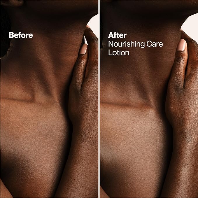 Suave Nourishing Care Hand & Body Lotion with Shea Butter for Women, Deep Moisture for Dry Skin, Fast Absorbing, Allergen Free Moisturizing Cream, 18FL OZ, 6 Pack